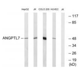 Western blot - ANGPTL7 Antibody from Signalway Antibody (34422) - Antibodies.com