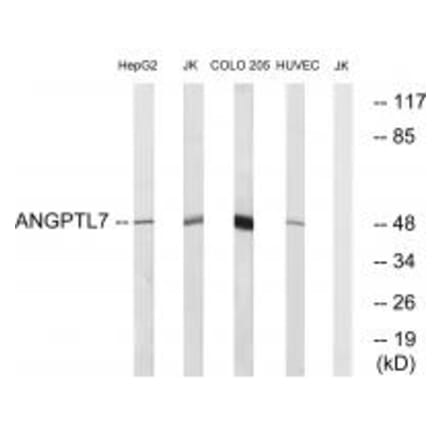 Western blot - ANGPTL7 Antibody from Signalway Antibody (34422) - Antibodies.com