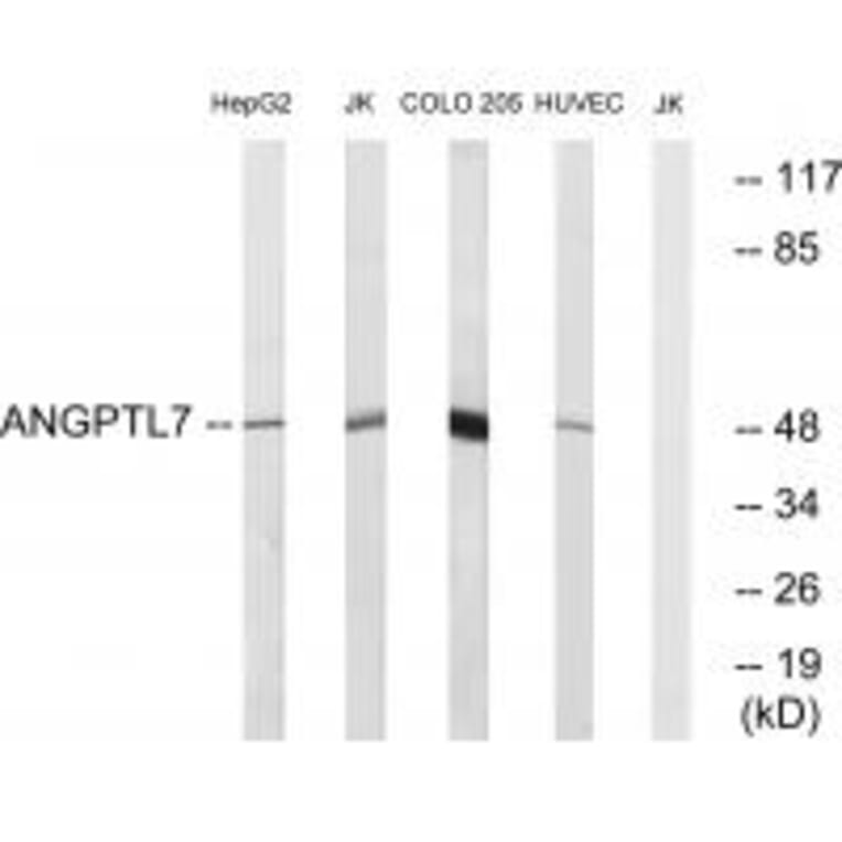 Western blot - ANGPTL7 Antibody from Signalway Antibody (34422) - Antibodies.com