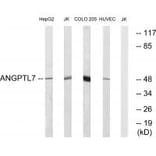 Western blot - ANGPTL7 Antibody from Signalway Antibody (34422) - Antibodies.com
