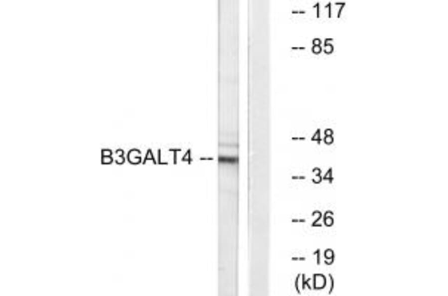 Western blot - B3GALT4 Antibody from Signalway Antibody (34487) - Antibodies.com