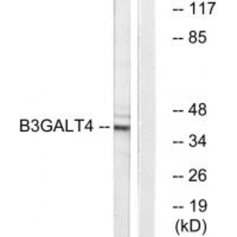Western blot - B3GALT4 Antibody from Signalway Antibody (34487) - Antibodies.com