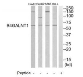 Western blot - B4GALNT1 Antibody from Signalway Antibody (34491) - Antibodies.com