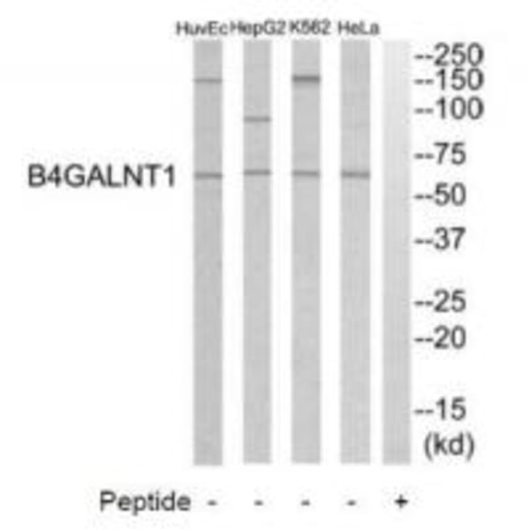 Western blot - B4GALNT1 Antibody from Signalway Antibody (34491) - Antibodies.com