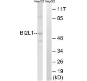 Western blot - BAIAP2L1 Antibody from Signalway Antibody (34506) - Antibodies.com
