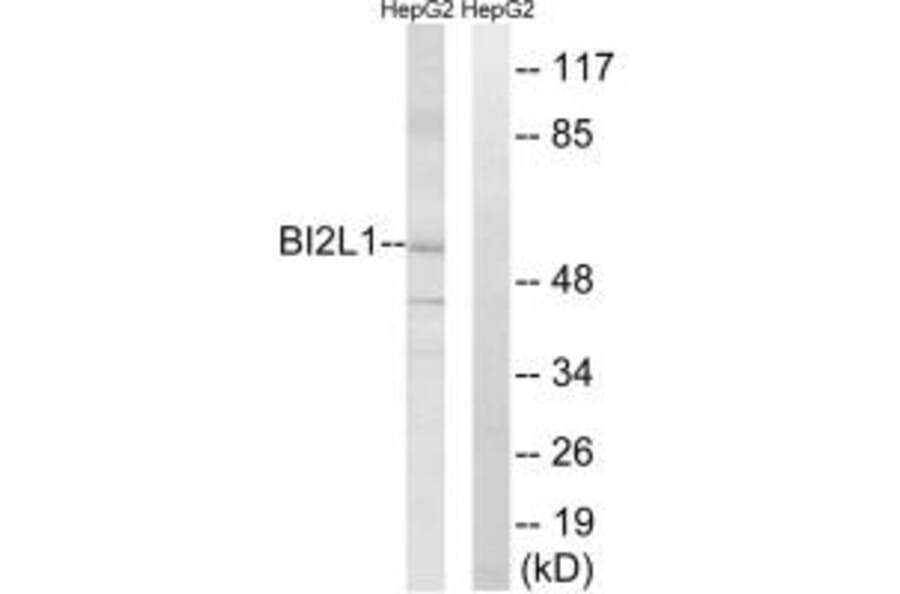 Western blot - BAIAP2L1 Antibody from Signalway Antibody (34506) - Antibodies.com