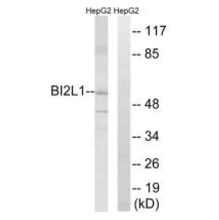 Western blot - BAIAP2L1 Antibody from Signalway Antibody (34506) - Antibodies.com
