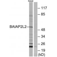 Western blot analysis of extracts from RAW264.7 cells, using BAIAP2L2 antibody #34507.