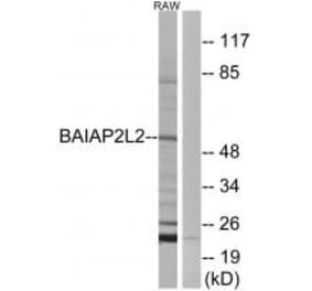 Western blot - BAIAP2L2 Antibody from Signalway Antibody (34507) - Antibodies.com