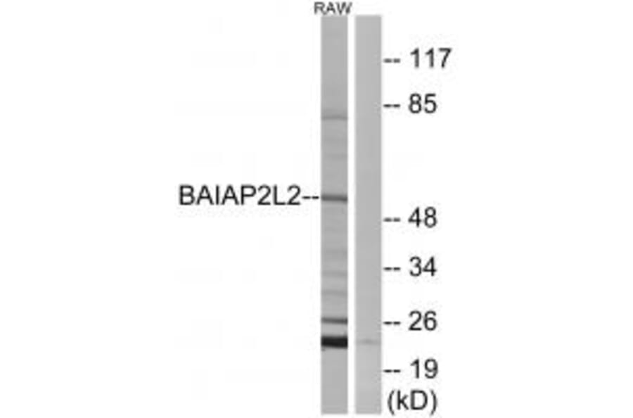 Western blot - BAIAP2L2 Antibody from Signalway Antibody (34507) - Antibodies.com