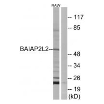 Western blot - BAIAP2L2 Antibody from Signalway Antibody (34507) - Antibodies.com