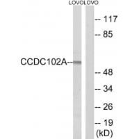 Western blot analysis of extracts from LOVO cells, using CCDC102A antibody #34604.