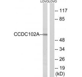 Western blot - CCDC102A Antibody from Signalway Antibody (34604) - Antibodies.com