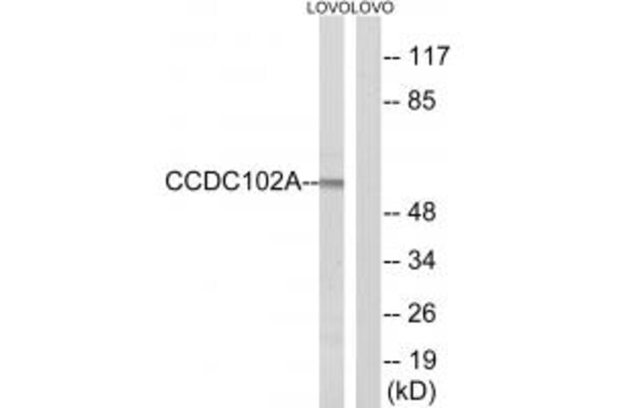 Western blot - CCDC102A Antibody from Signalway Antibody (34604) - Antibodies.com