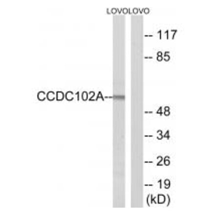 Western blot - CCDC102A Antibody from Signalway Antibody (34604) - Antibodies.com