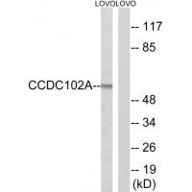 Western blot - CCDC102A Antibody from Signalway Antibody (34604) - Antibodies.com