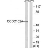 Western blot - CCDC102A Antibody from Signalway Antibody (34604) - Antibodies.com