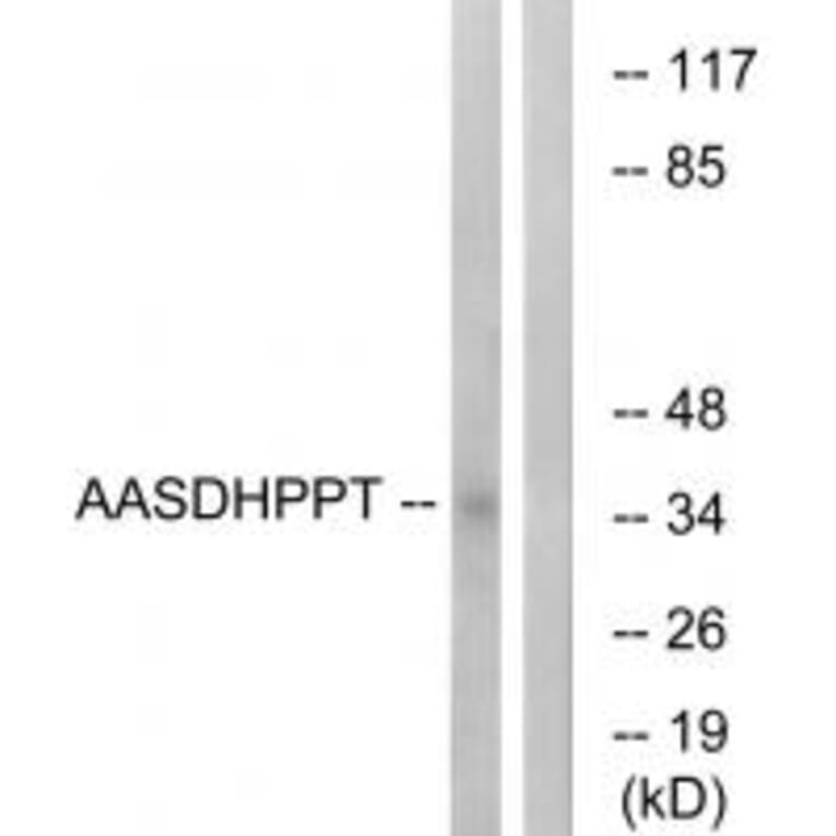 Western blot - AASDHPPT Antibody from Signalway Antibody (34753) - Antibodies.com
