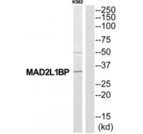 Western blot - MAD2L1BP Antibody from Signalway Antibody (34774) - Antibodies.com