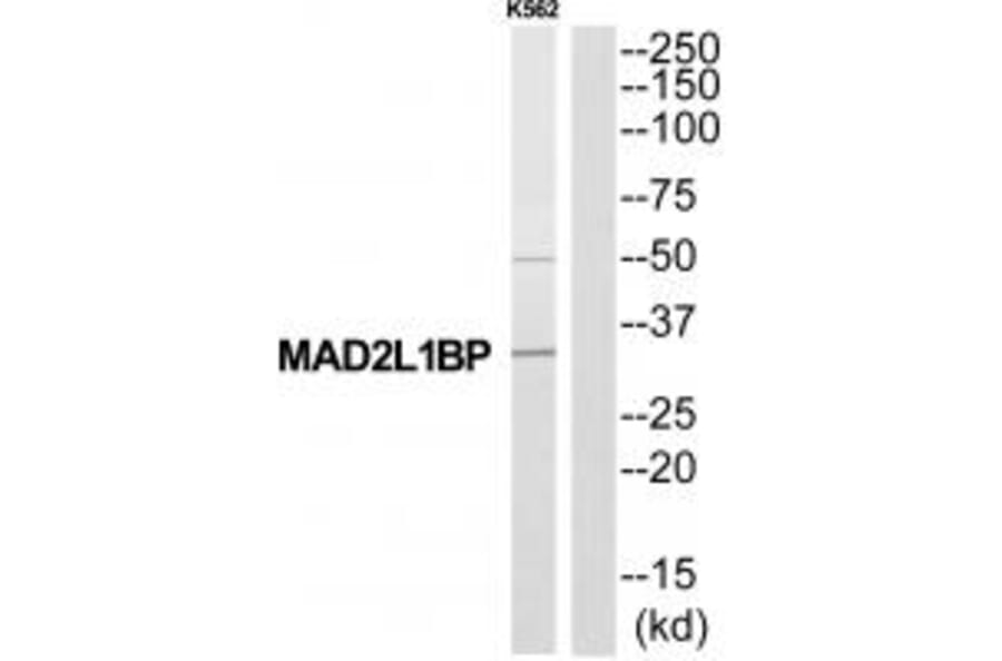 Western blot - MAD2L1BP Antibody from Signalway Antibody (34774) - Antibodies.com