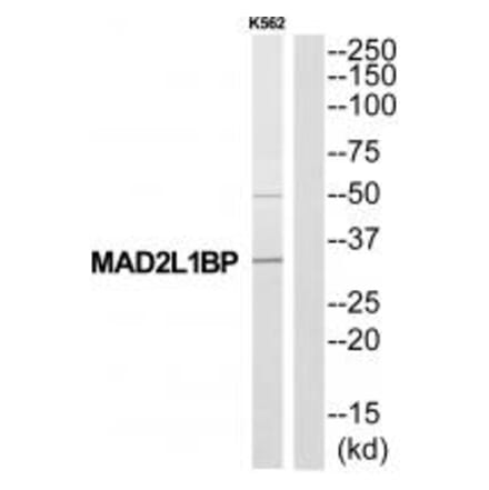 Western blot - MAD2L1BP Antibody from Signalway Antibody (34774) - Antibodies.com