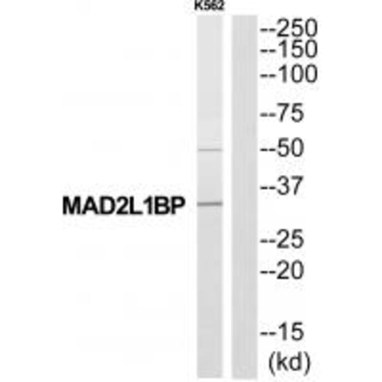 Western blot - MAD2L1BP Antibody from Signalway Antibody (34774) - Antibodies.com