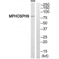 Western blot analysis of extracts from A549 cells, using MPHOSPH9 antibody #34809.