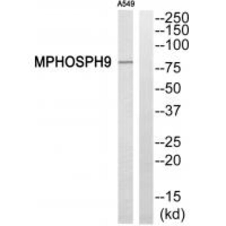 Western blot - MPHOSPH9 Antibody from Signalway Antibody (34809) - Antibodies.com