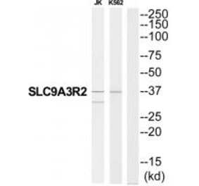 Western blot - SLC9A3R2 Antibody from Signalway Antibody (34825) - Antibodies.com