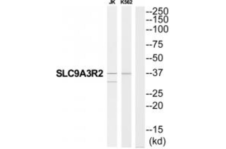 Western blot - SLC9A3R2 Antibody from Signalway Antibody (34825) - Antibodies.com