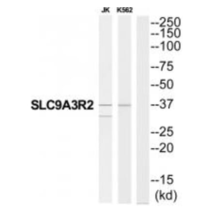 Western blot - SLC9A3R2 Antibody from Signalway Antibody (34825) - Antibodies.com