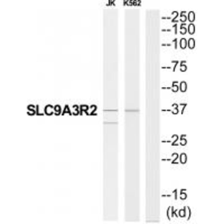 Western blot - SLC9A3R2 Antibody from Signalway Antibody (34825) - Antibodies.com