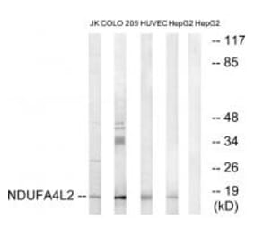 Western blot - NDUFA4L2 Antibody from Signalway Antibody (34828) - Antibodies.com