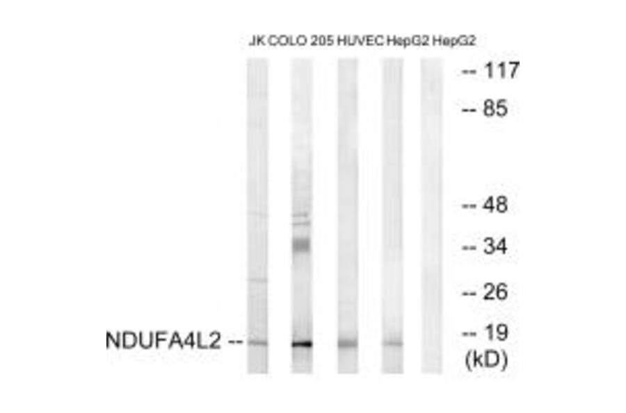 Western blot - NDUFA4L2 Antibody from Signalway Antibody (34828) - Antibodies.com