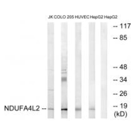 Western blot - NDUFA4L2 Antibody from Signalway Antibody (34828) - Antibodies.com