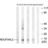 Western blot - NDUFA4L2 Antibody from Signalway Antibody (34828) - Antibodies.com