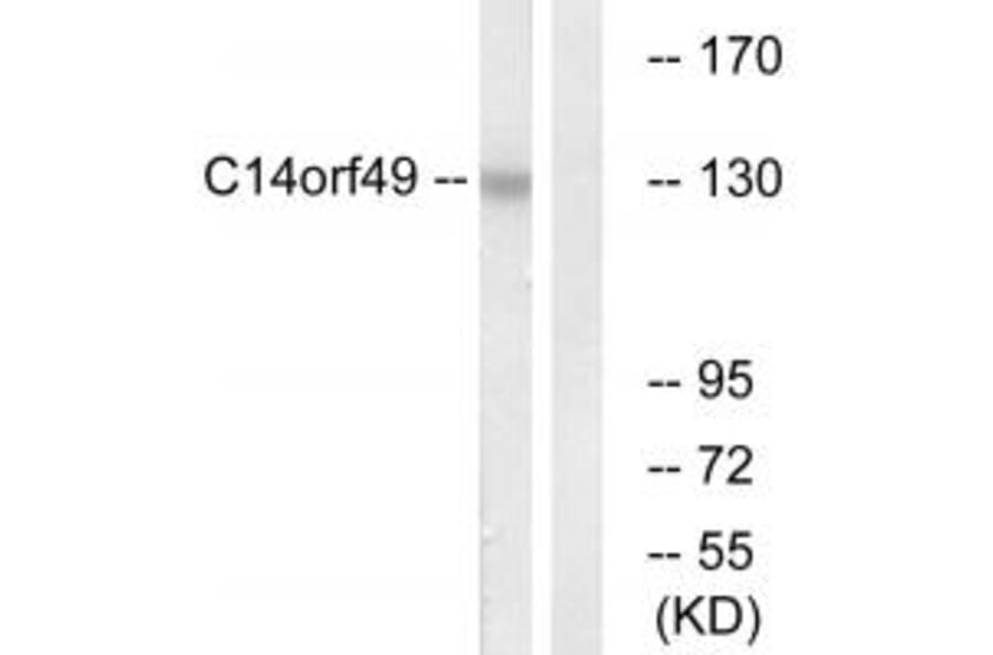 Western blot - C14orf49 Antibody from Signalway Antibody (34847) - Antibodies.com