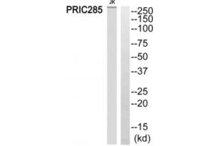 Western blot - PRIC285 Antibody from Signalway Antibody (34893) - Antibodies.com