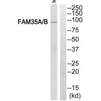 Western blot analysis of extracts from Jurkat cells, using FAM35A/B antibody #34929.