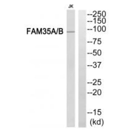 Western blot - FAM35A/B Antibody from Signalway Antibody (34929) - Antibodies.com