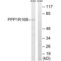 Western blot analysis of extracts from mouse brain cells, using PPP1R16B antibody #34931.