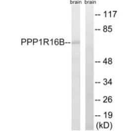 Western blot - PPP1R16B Antibody from Signalway Antibody (34931) - Antibodies.com