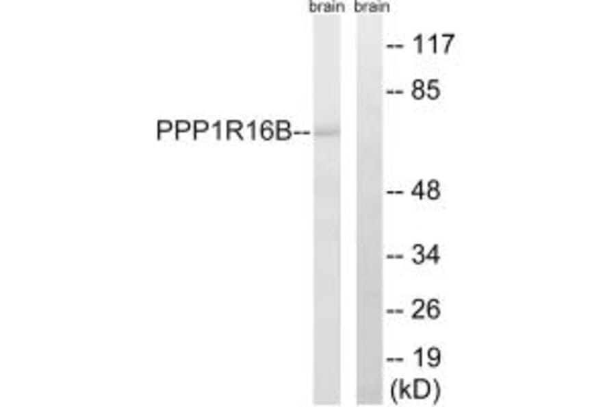 Western blot - PPP1R16B Antibody from Signalway Antibody (34931) - Antibodies.com