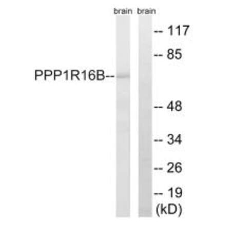 Western blot - PPP1R16B Antibody from Signalway Antibody (34931) - Antibodies.com