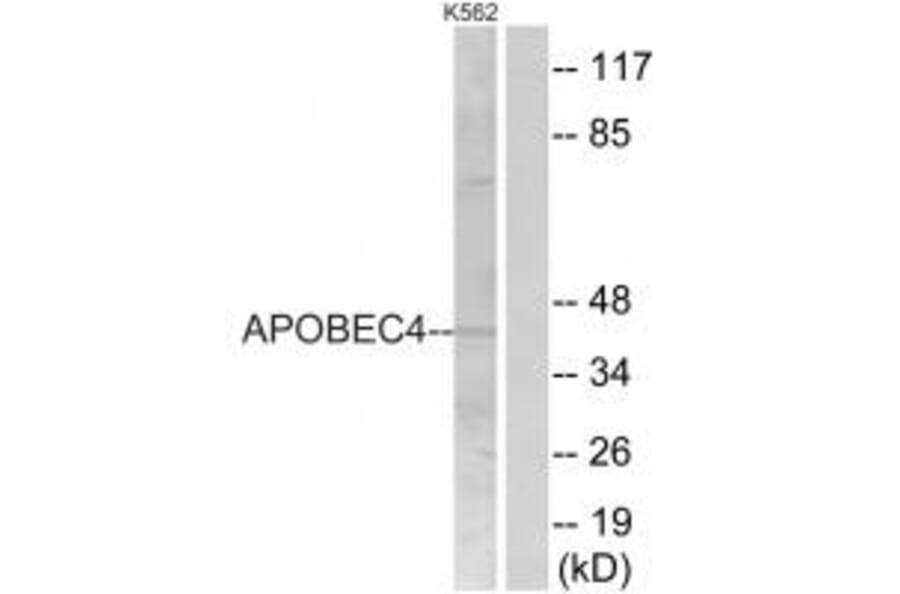 Western blot - APOBEC4 Antibody from Signalway Antibody (34940) - Antibodies.com