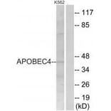 Western blot - APOBEC4 Antibody from Signalway Antibody (34940) - Antibodies.com