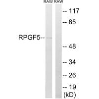 Western blot analysis of extracts from RAW264.7 cells, using RAPGEF5 antibody #34959.