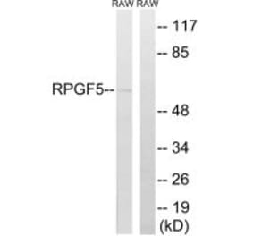 Western blot - RAPGEF5 Antibody from Signalway Antibody (34959) - Antibodies.com