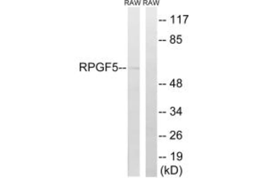 Western blot - RAPGEF5 Antibody from Signalway Antibody (34959) - Antibodies.com