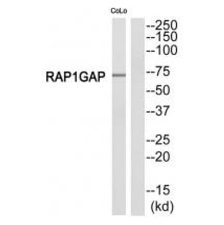 Western blot - RAP1GDS1 Antibody from Signalway Antibody (34960) - Antibodies.com